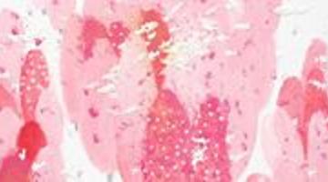 문혜린 개인展 - 꿈꾸다